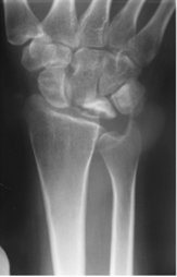Hand iSAWE KB, Diagnosis