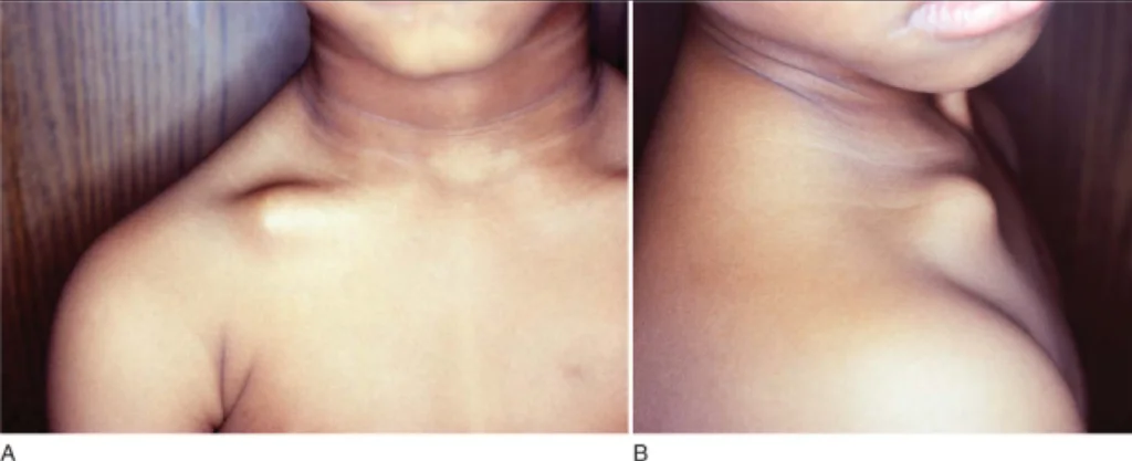 Paeds Elective iSAWE 13, case image