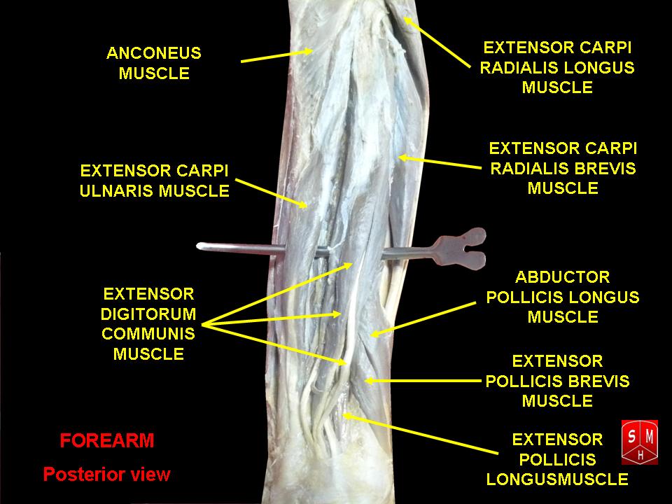 Approach to Posterior Radius, dissection of the posterior forearm showing the extensor muscles