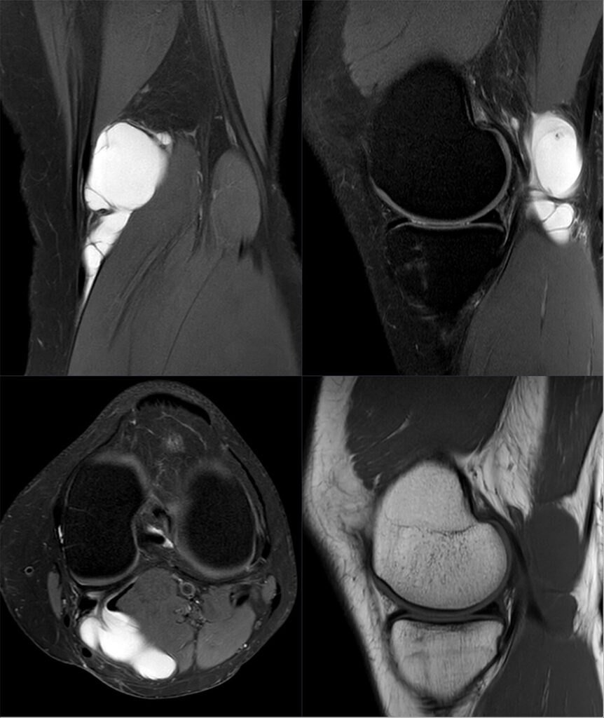 Knee iSAWE 14, MRI of the knee