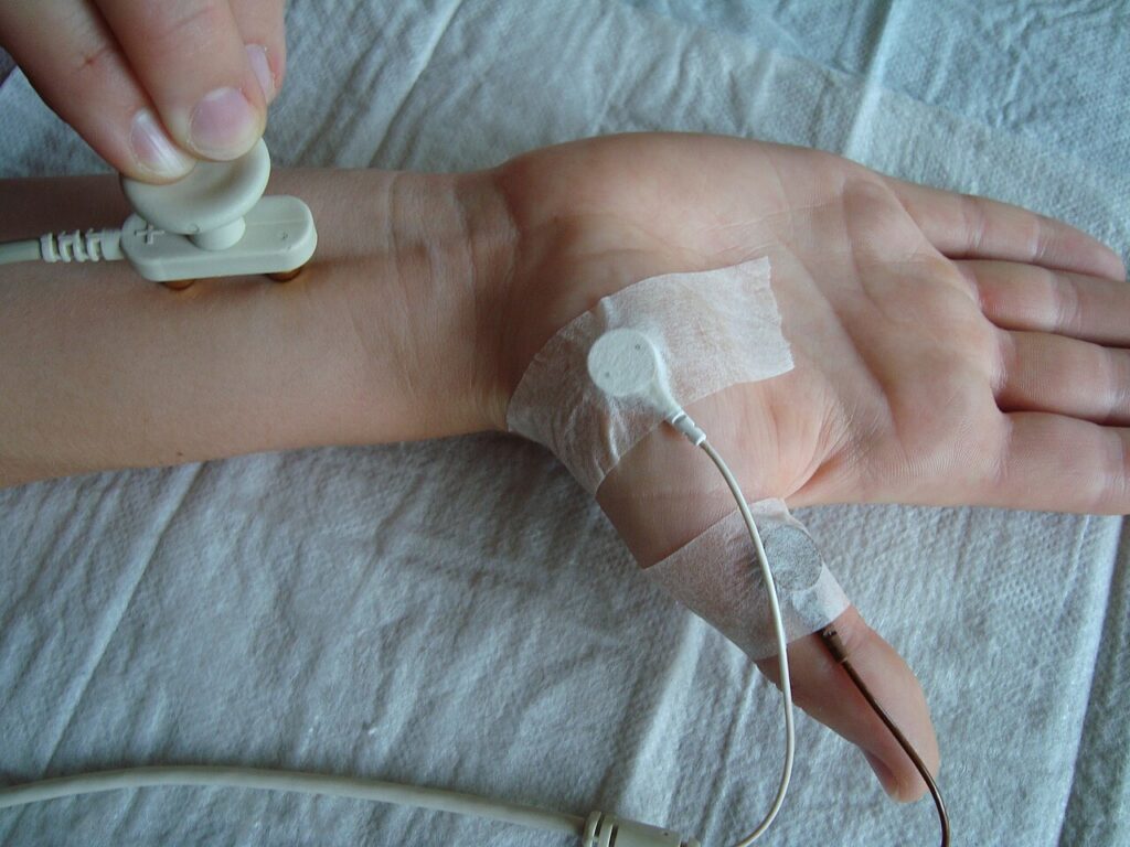 Clinical Nerve Conduction and Needle EMG Studies, recording a nerve conduction study