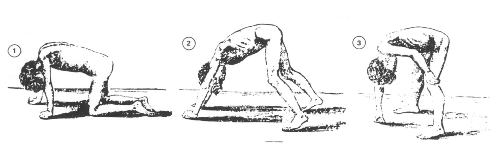 Duchenne Muscular Dystrophy, gowers sign in duchenne muscular dystrophy