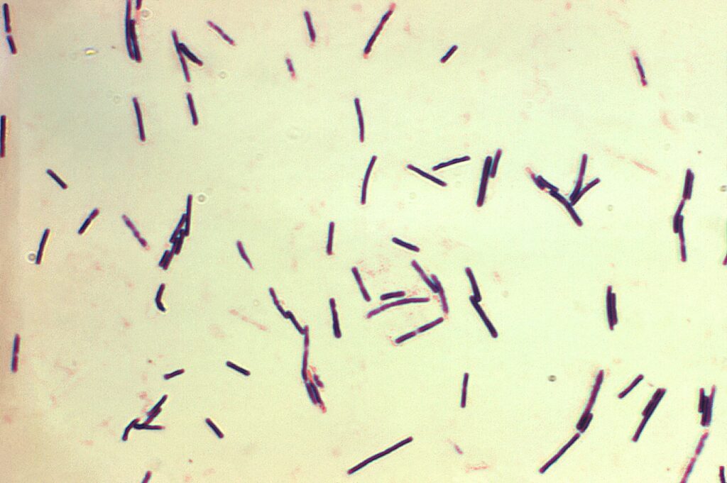 Gas Gangrene, gram stain of clostridium perfringens, the organism responsible for most cases of gas gangrene