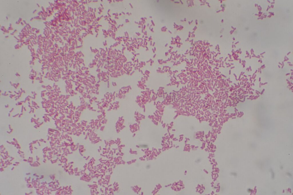 Gram Negative Enteric Bacteria, gram stain of escherichia coli, a gram negative enteric bacillus