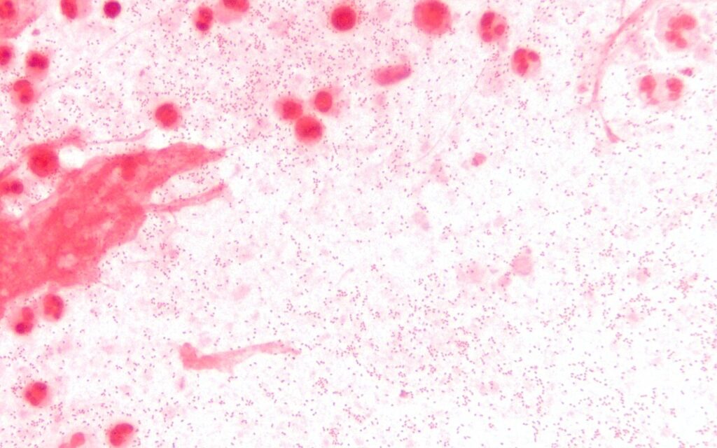 Haemophilus, gram stain of haemophilus influenzae