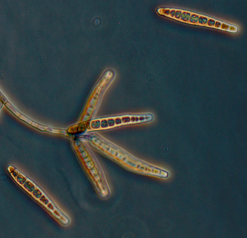 Mycotic Infections, photomicrograph of the fungus exserohilum rostratum