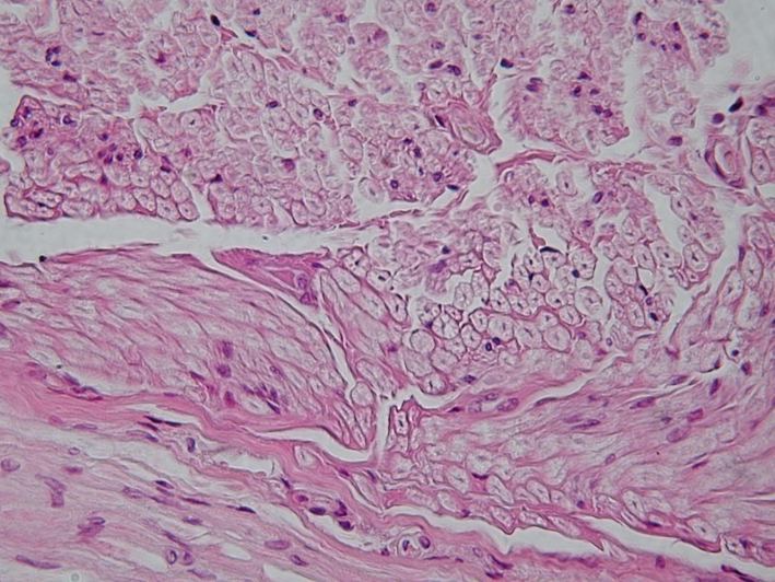 Nerves, histology of a peripheral nerve in cross section