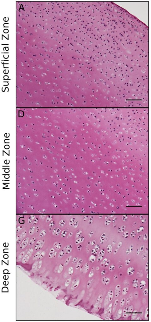 Normal Tissues, histology of the zones of articular cartilage