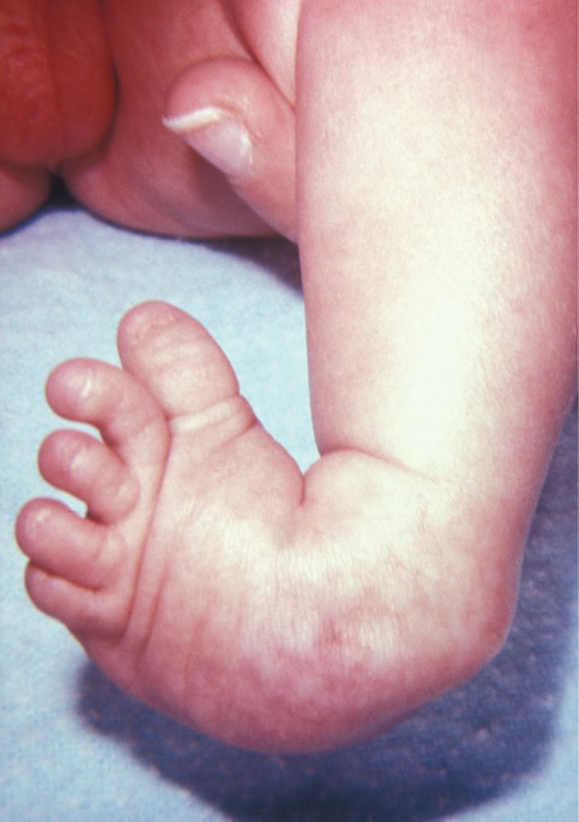 Paeds Elective iSAWE 4, clinical photograph