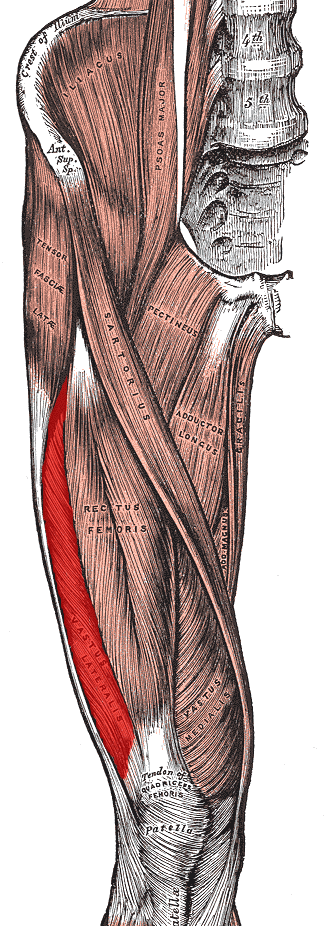 Posterolateral Approach to the Femur, vastus lateralis