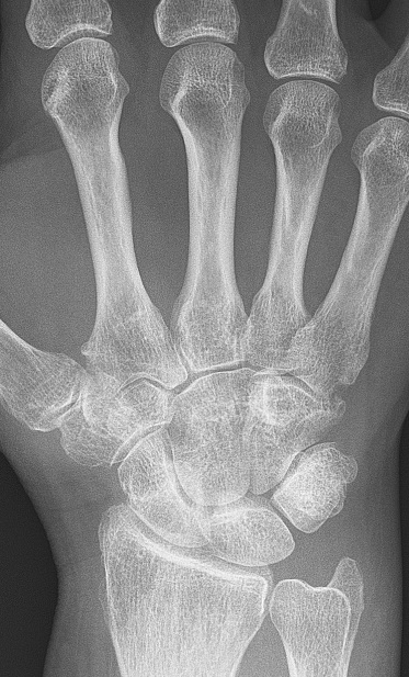 Radiograph of the hand and wrist