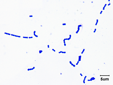 Streptococci, gram stain of streptococcus pyogenes