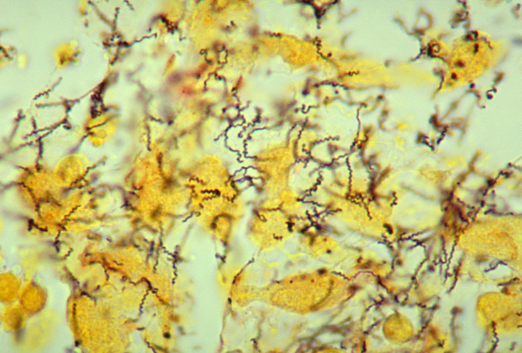 Syphilis, treponema pallidum, the organism causing syphilis