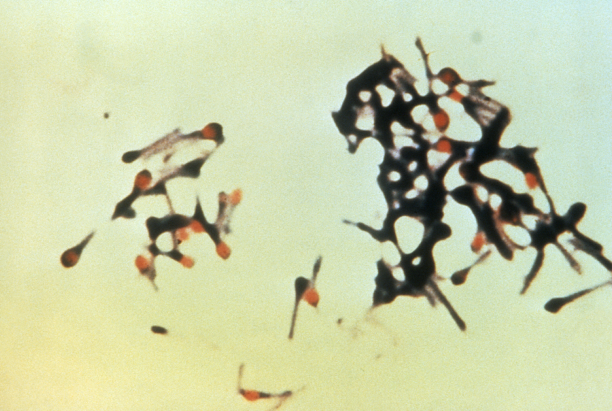 Tetanus, clostridium tetani, the organism causing tetanus
