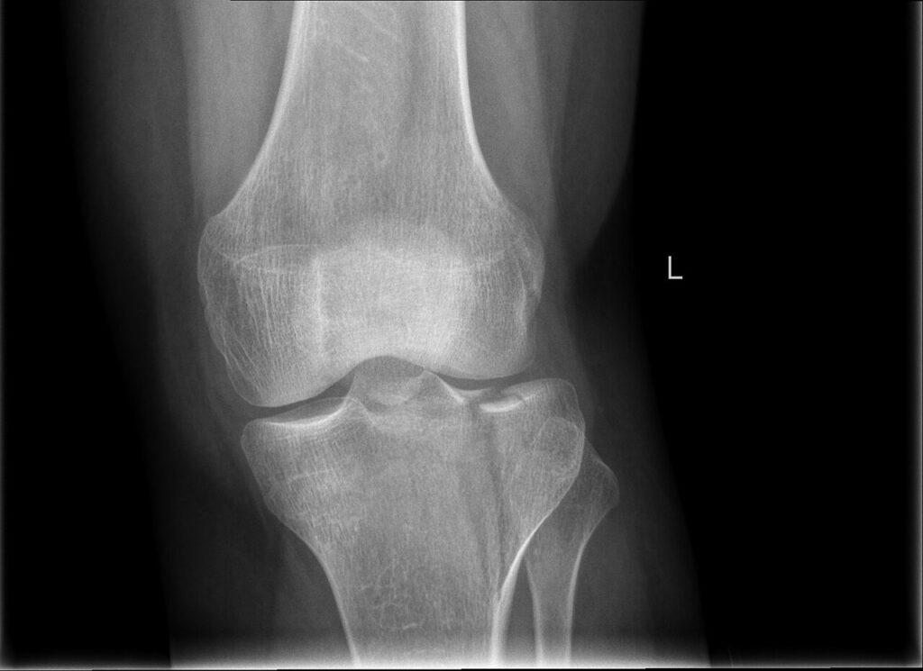 Knee iSAWE 9, imaging of the knee