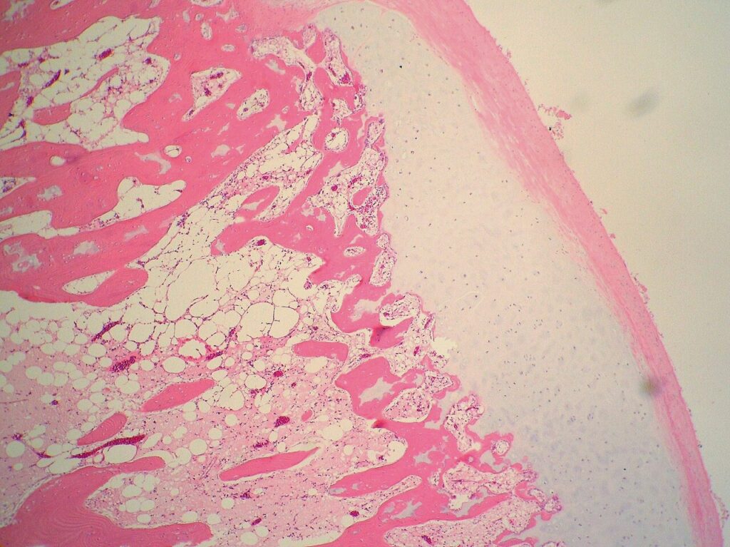 Histology of an osteochondroma at medium power